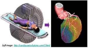 Why a little radiation is good for you: taking it to your heart